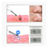 TOUCHBeauty 1887 Ultrazvuková špachtle na pleť