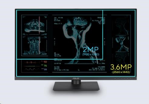 Obr. Vysoké rozlišení 3,6 MP 1771422d