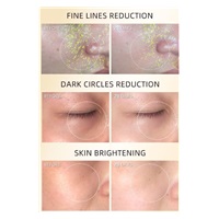 JOVS 4D laserová světelná terapeutická maska