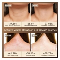 JOVS LED světelná maska na krk a hrudník