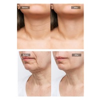 JOVS LED světelná maska na krk a hrudník