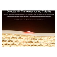 JOVS přístroj na léčbu akné Acneaway