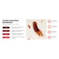 JOVS přístroj na léčbu akné Acneaway