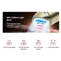 JOVS přístroj na léčbu akné Acneaway