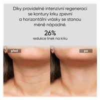 JOVS LED světelná maska na krk a hrudník
