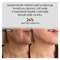 JOVS LED světelná maska na krk a hrudník