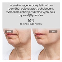 JOVS LED světelná maska na krk a hrudník